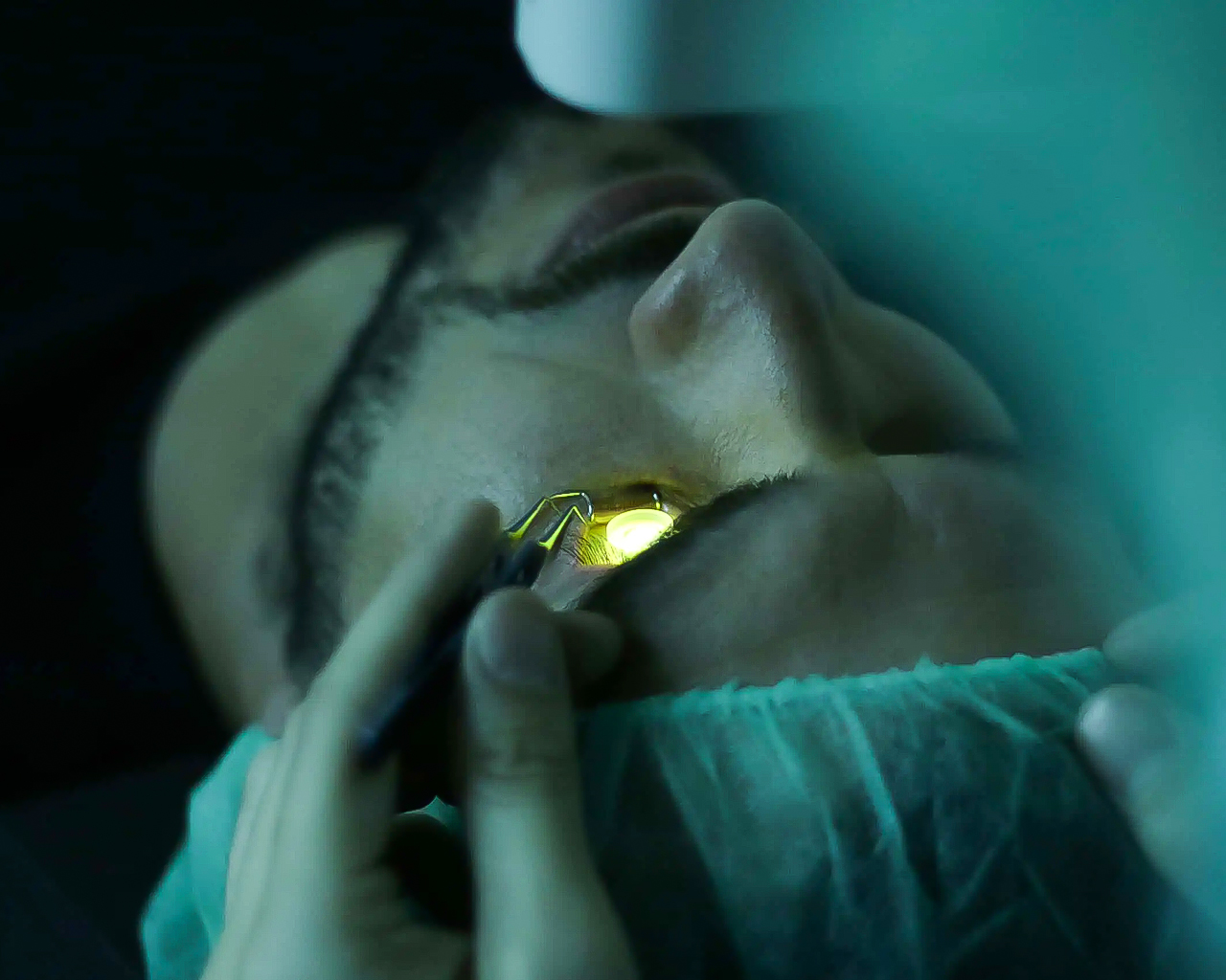 Corneal Cross-Linking